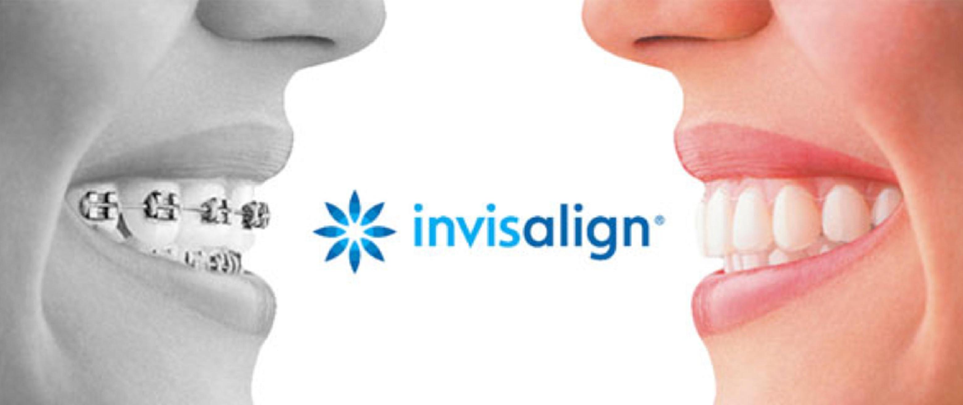 Save Your Smile With Invisalign® Invisible Aligners - Bull City Dental